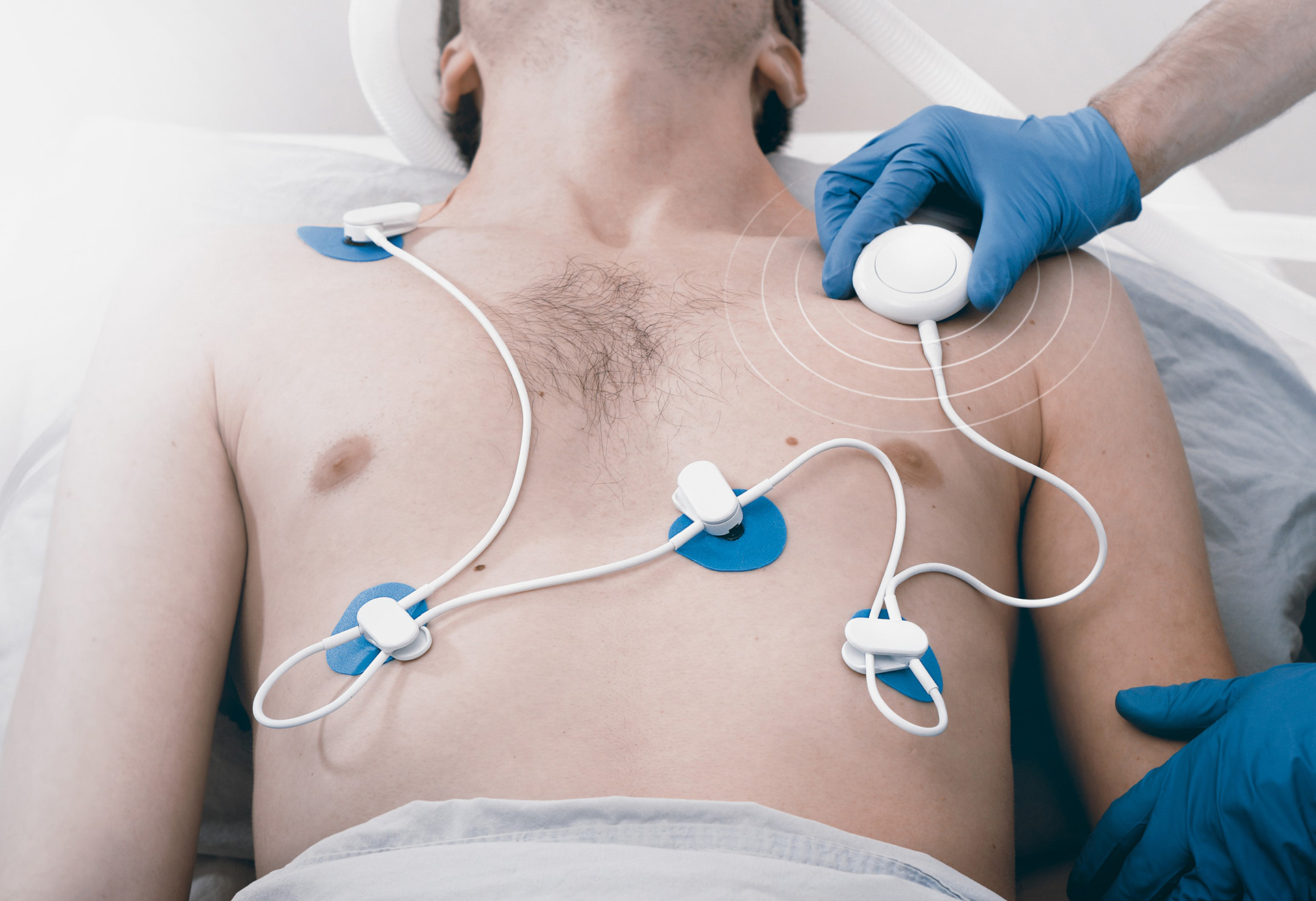 Array — ECG monitoring system